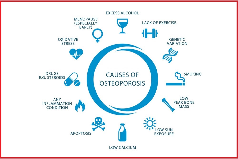 Osteoporosis: "Problem of weakening bones and breaking them"